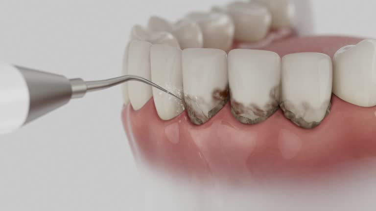 Trusted Root Canal Treatment service in Maryville, TN - Dentist Open Now